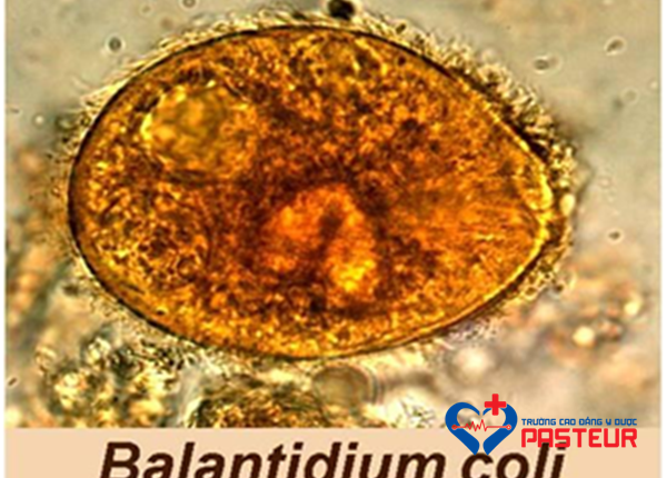 Đặc điểm sinh học của trùng lông Balantidium coli