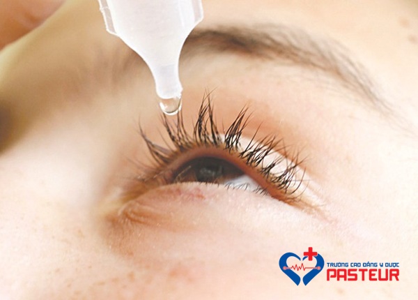 Phương pháp điều trị cho bệnh nhân bị khô mắt