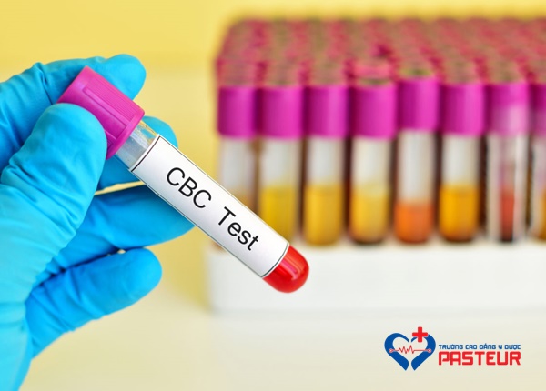 Tìm hiểu về xét nghiệm công thức máu toàn bộ (CBC)