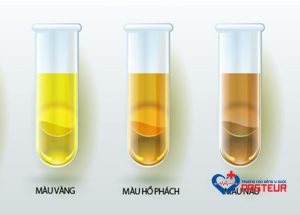 Thành phần hóa học của nước tiểu bình thường